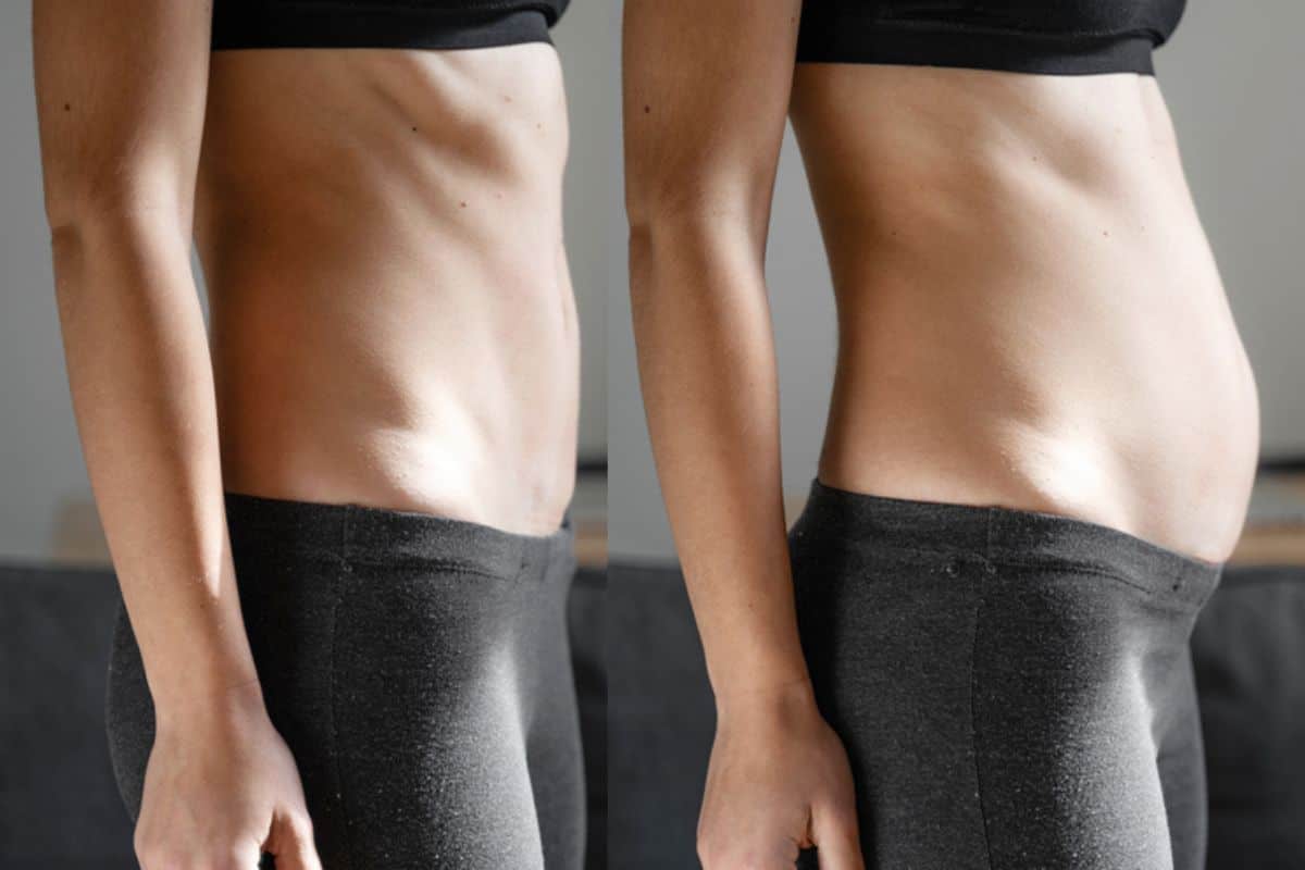 How long does diastasis recti take to improve Allesley?