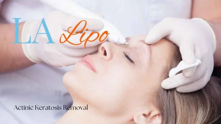 Woman receiving Actinic Keratosis Removal Treatment Allesley