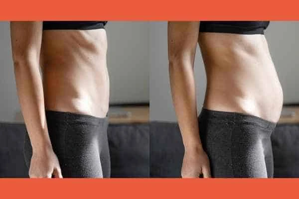 LA-EMS Body Sculpting results Allesley