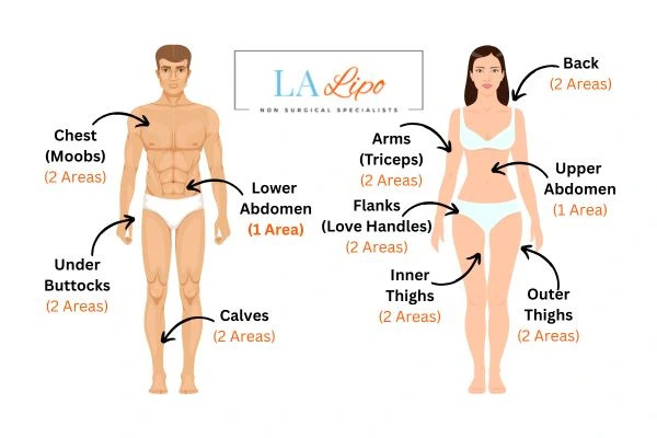 LA LIPO Cryolipolysis Areas Allesley