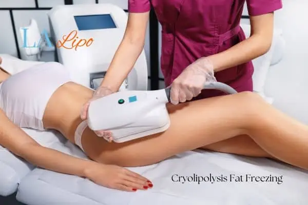 Woman receiving coolsculpting Allesley treatment on her thighs