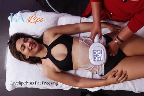 woman getting cryolipolysis Allesley