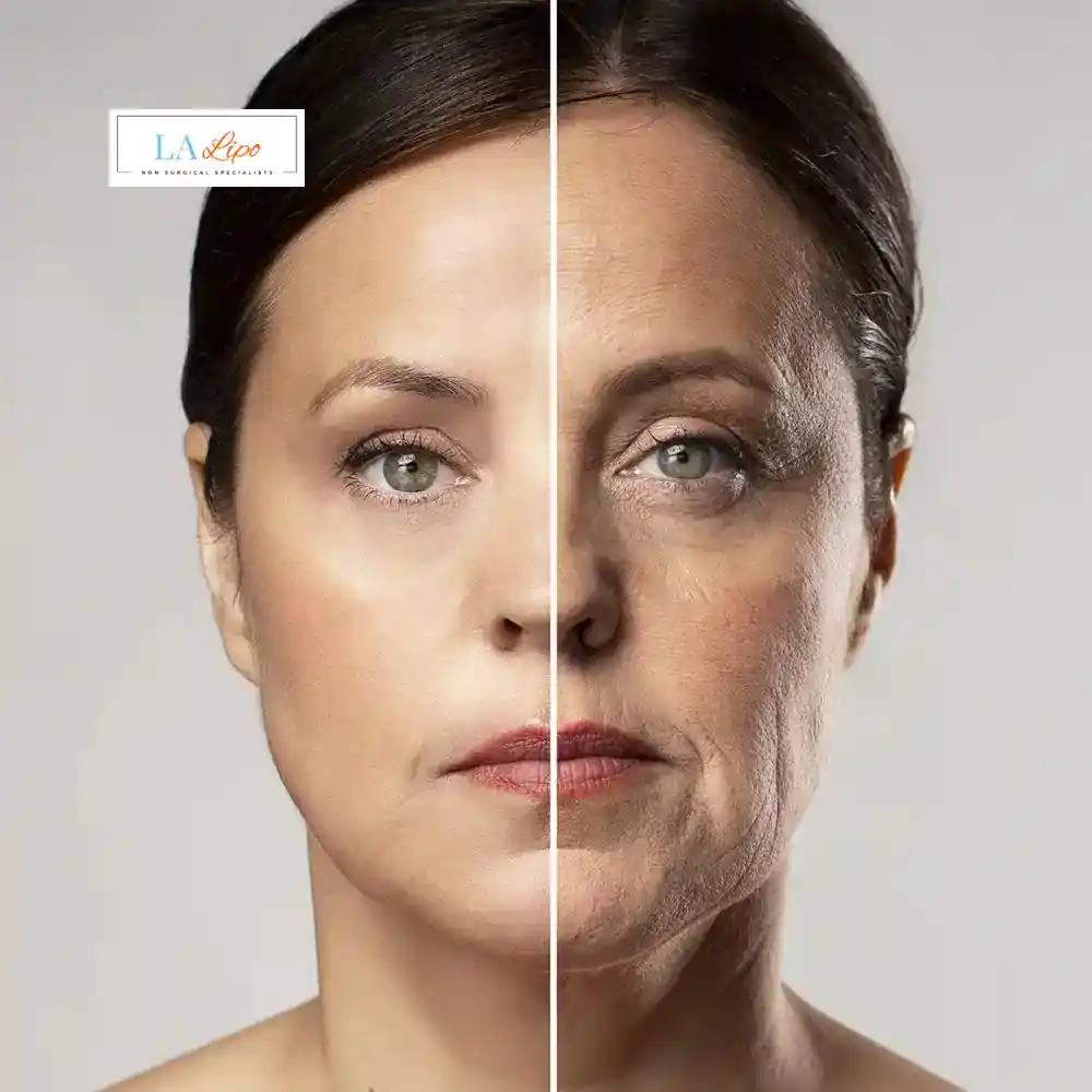 How Can You Tell If Non-Surgical Skin Tightening Is Right for You Allesley?