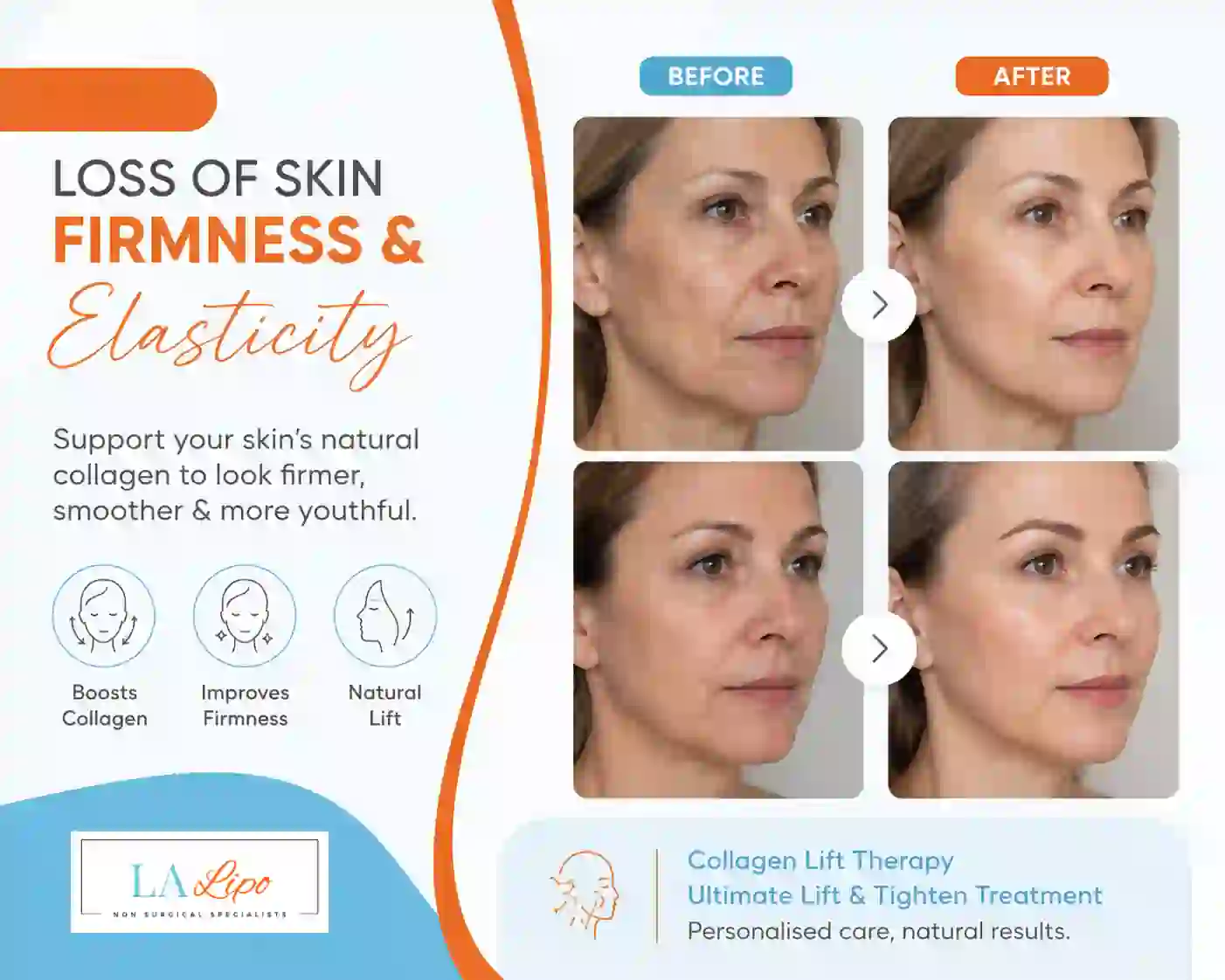 Sign #7: Loss of Skin Firmness and Elasticity Allesley